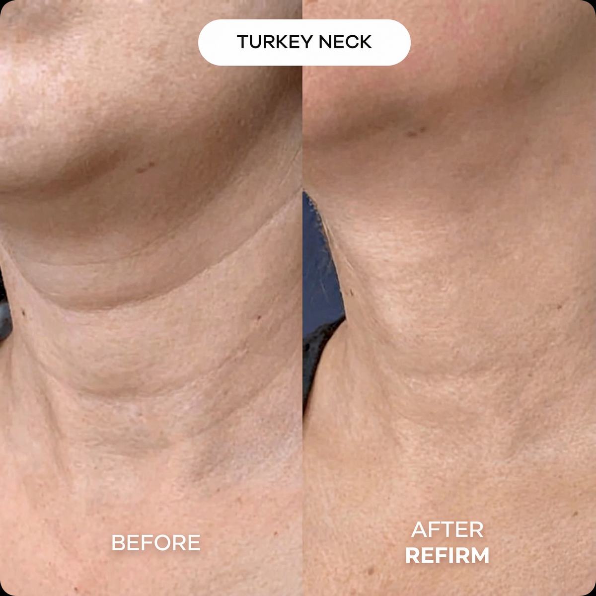 Refirm Calcium Balm