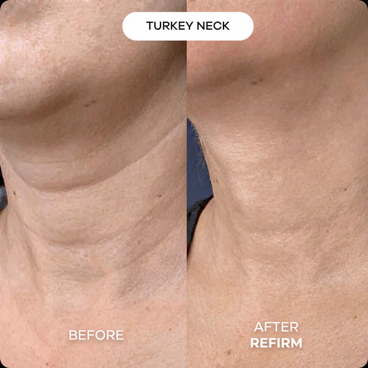 Refirm® Calcium Balm