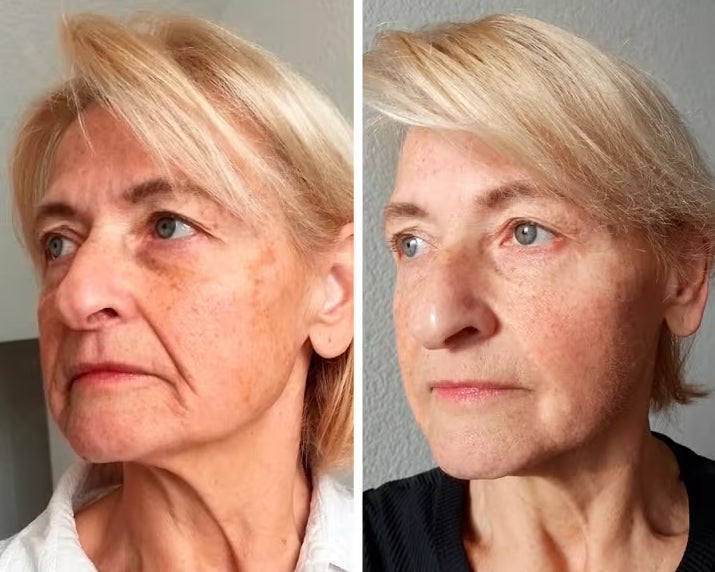 7. You can finally stop worrying about makeup settling into your lines by 10am