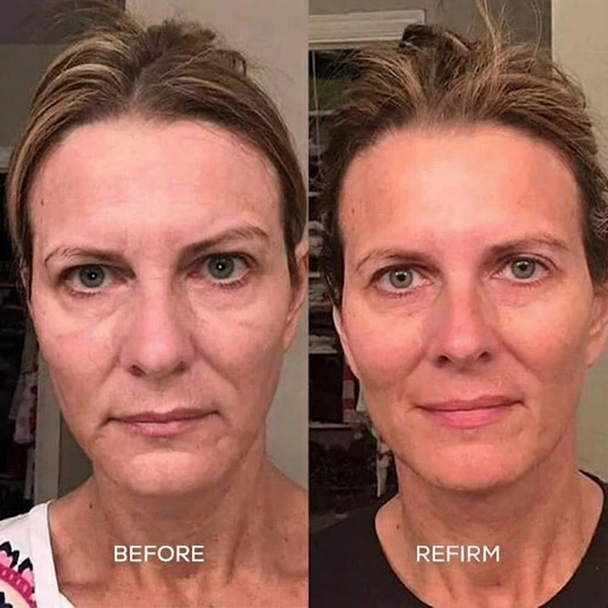 Refirm Calcium Balm