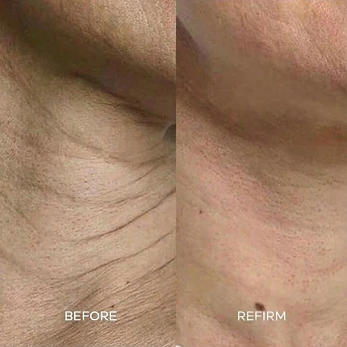 Refirm Calcium Balm