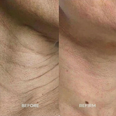 Refirm® Calcium Balm