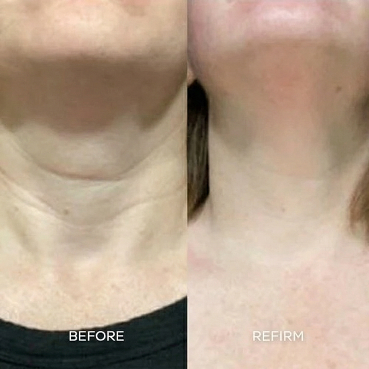 Refirm Calcium Balm
