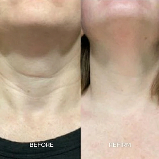 Refirm® Calcium Balm