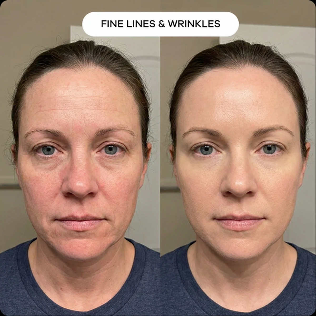 Refirm Calcium Balm