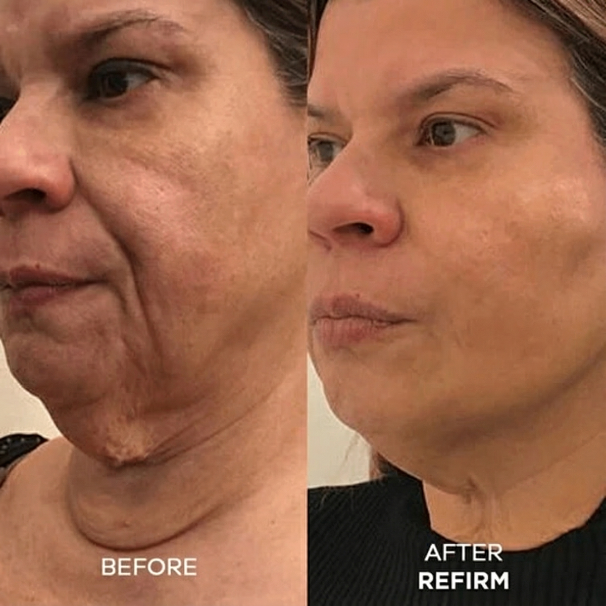 Refirm Calcium Balm