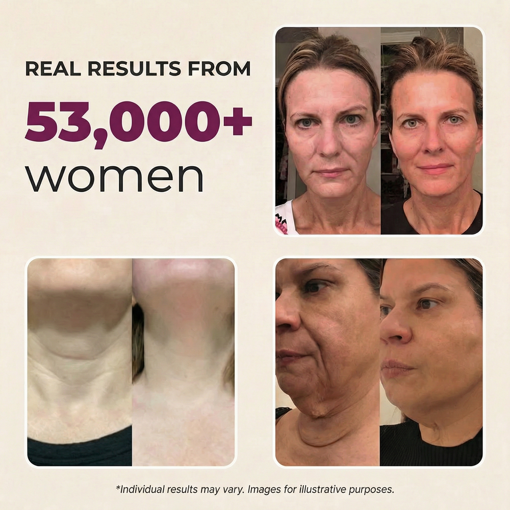 8. 87% of women report feeling less self-conscious about their lines within 30 days