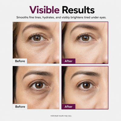 Refirm™ Anti Aging Calcium Balm