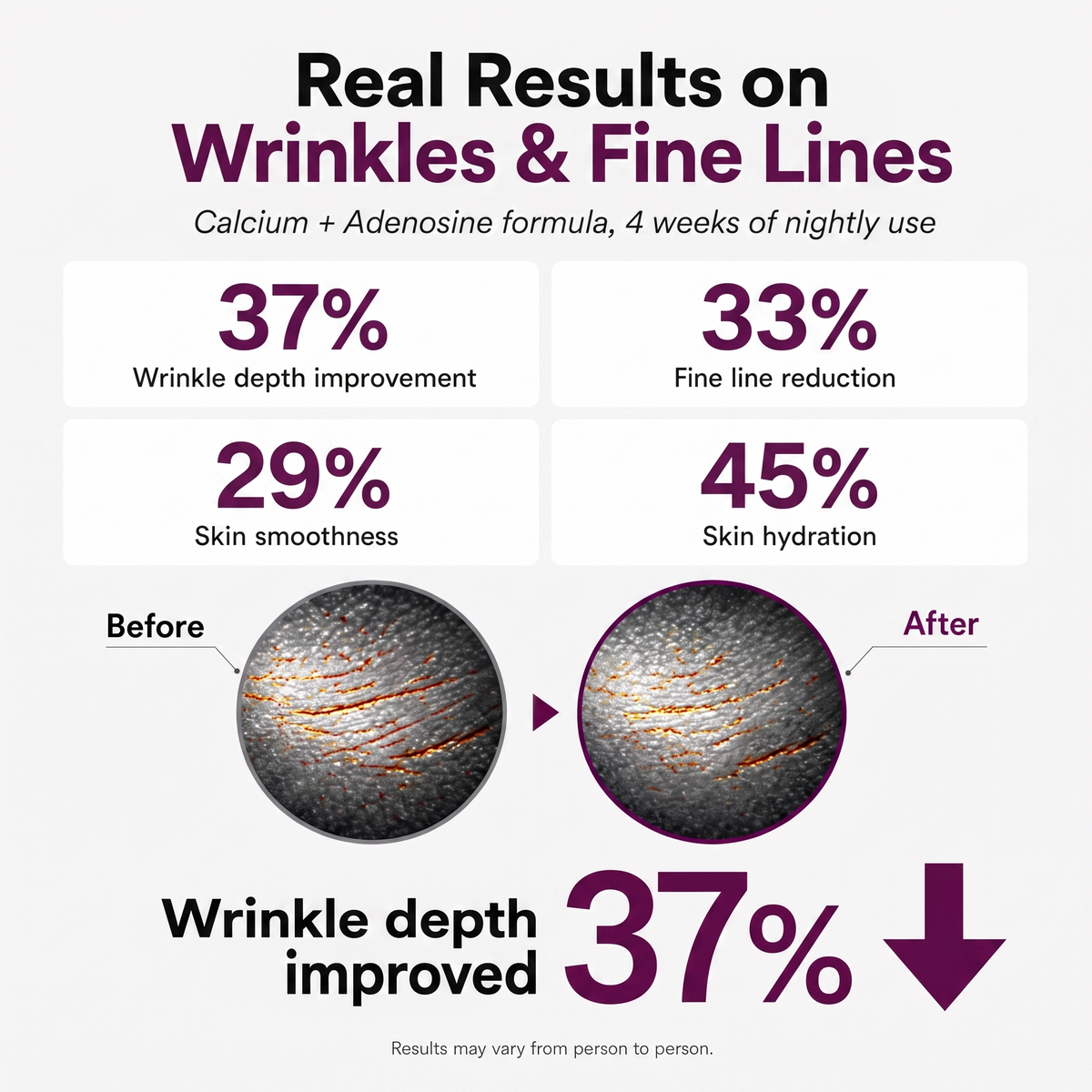 Real results on wrinkles and fine lines — Refirm calcium and adenosine formula