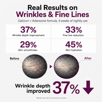 Real results on wrinkles and fine lines — Refirm calcium and adenosine formula
