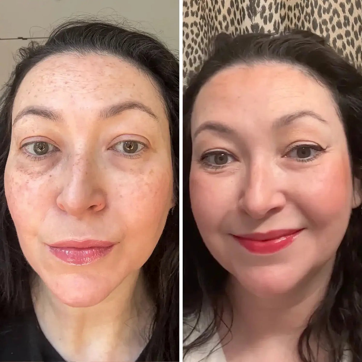 Refirm™ Anti Aging Calcium Balm