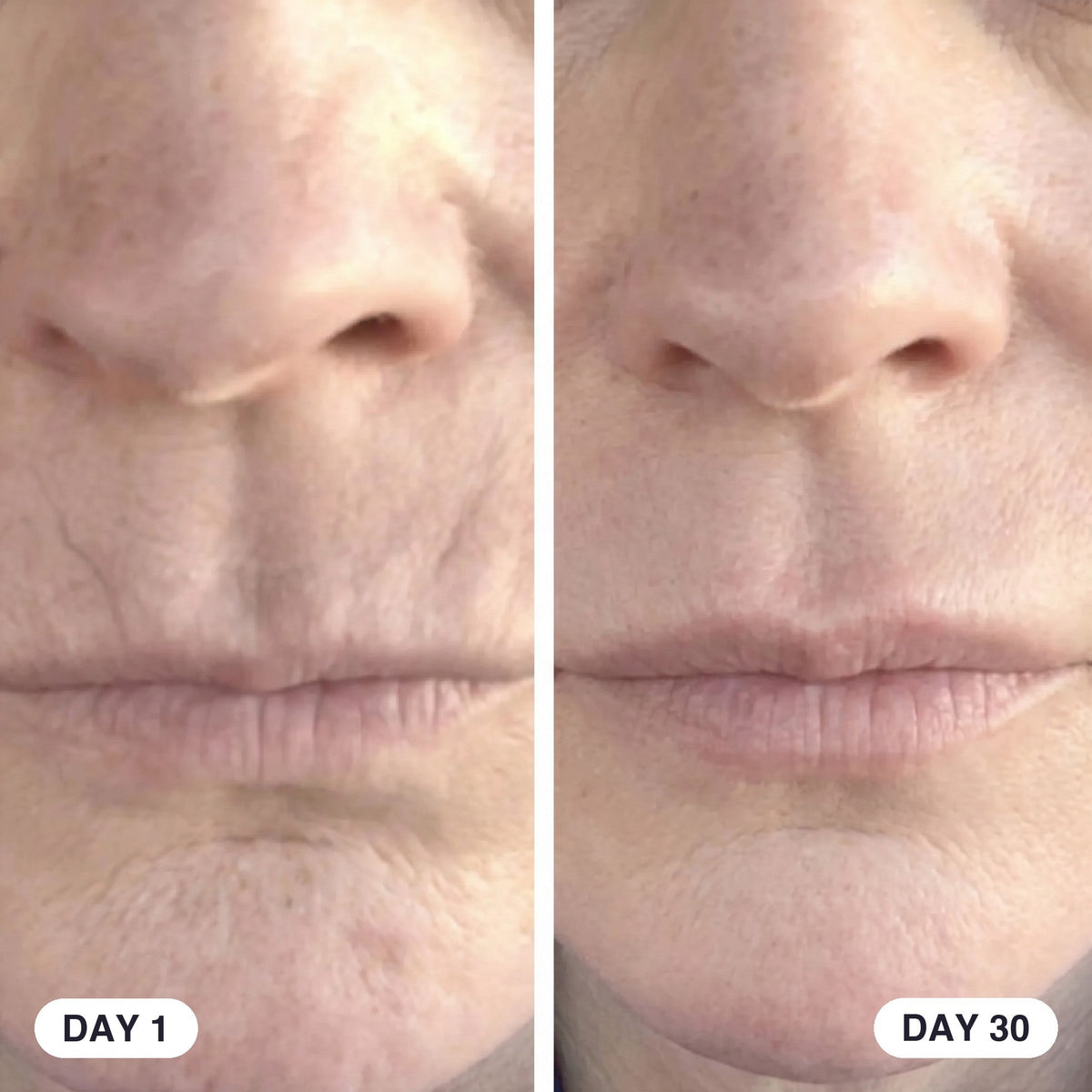 Refirm™ Anti Aging Calcium Balm