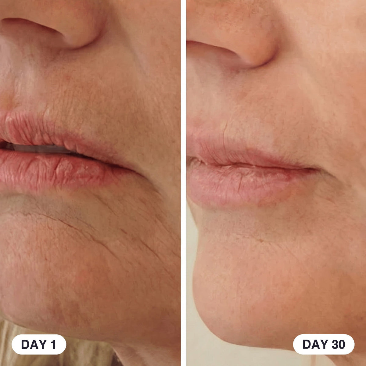 Refirm™ Anti Aging Calcium Balm