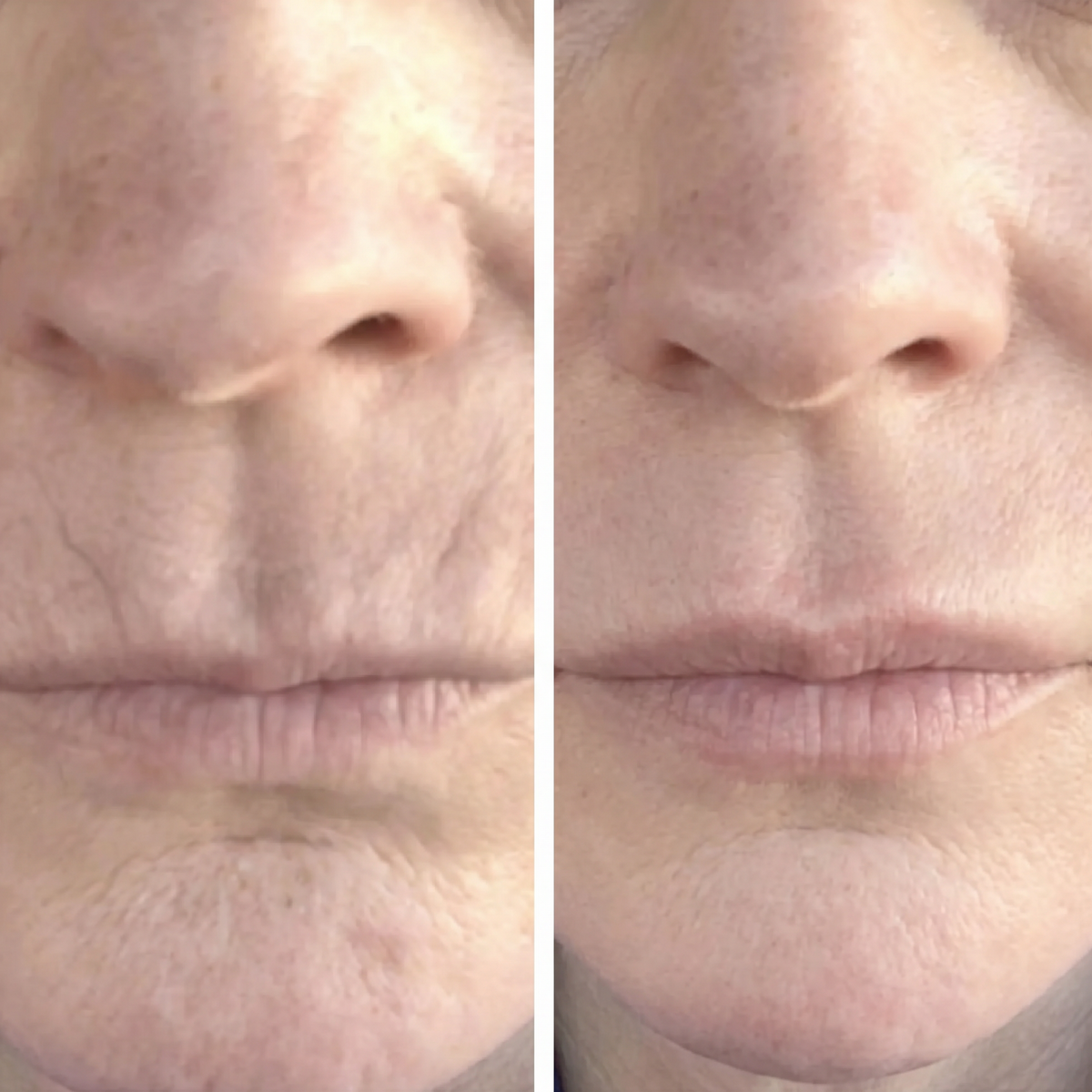 Refirm™ Anti Aging Calcium Balm