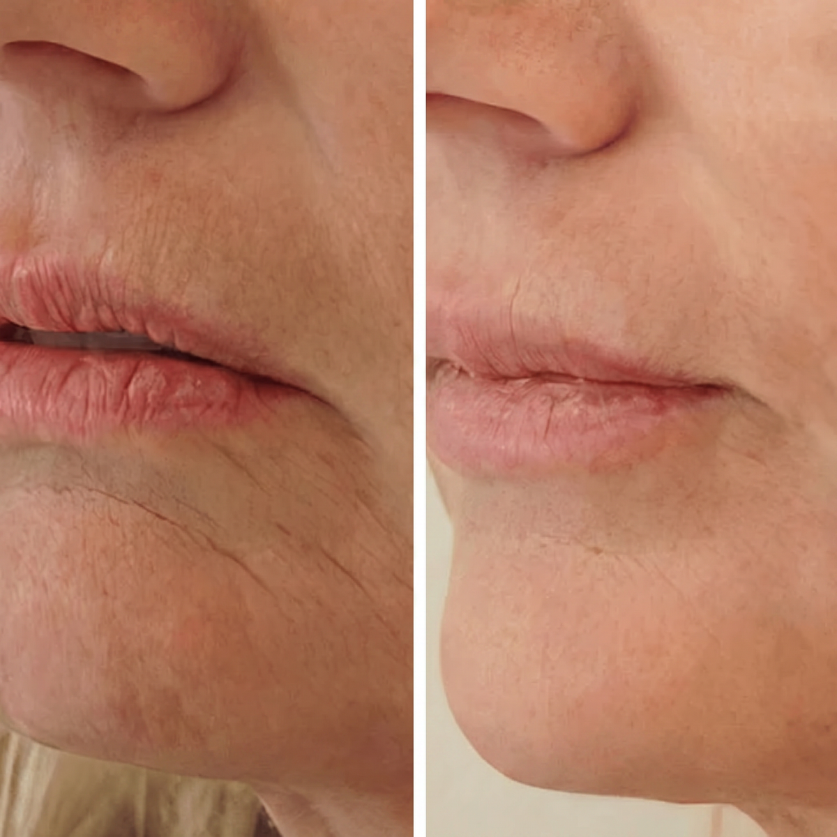 Refirm™ Anti Aging Calcium Balm